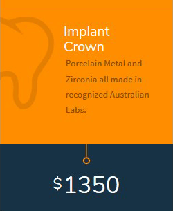 Implant Crown cost in Melbourne