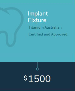 Implant Fixture cost in Melbourne