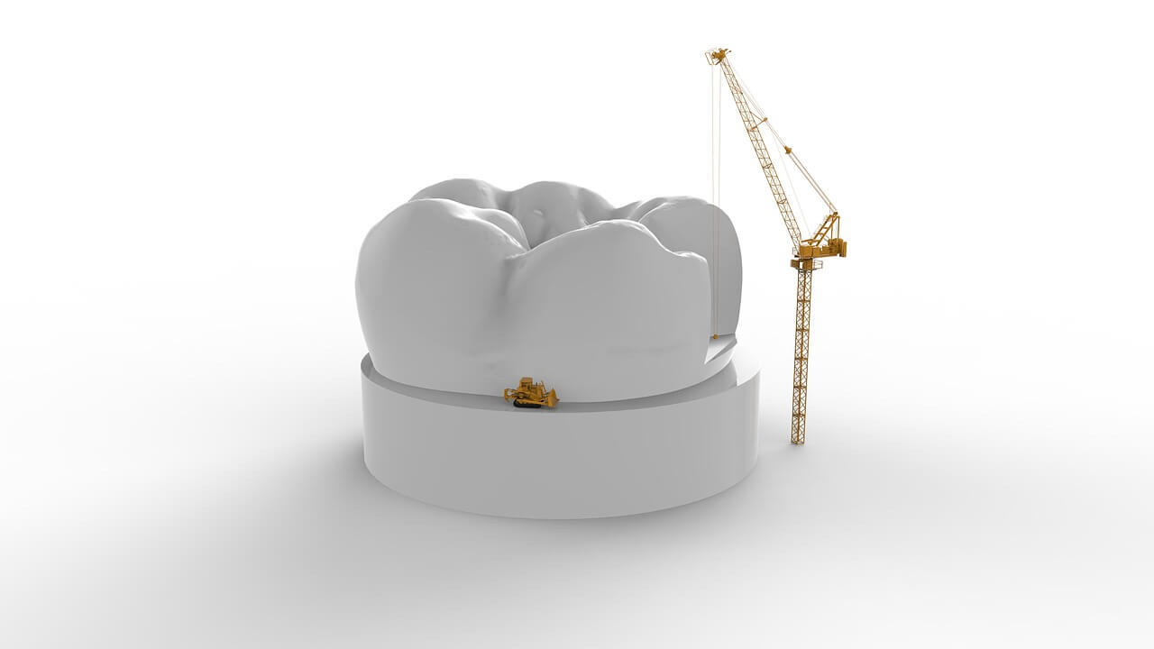 How Dental Implants Improve Your Quality of Life