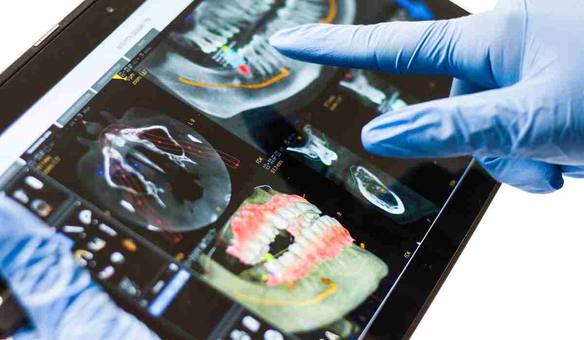 dental implants Melbourne