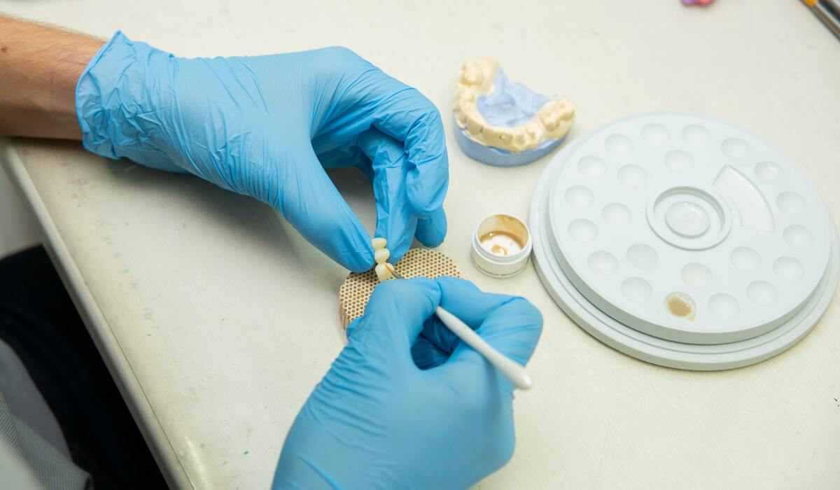 dental implants cost Melbourne